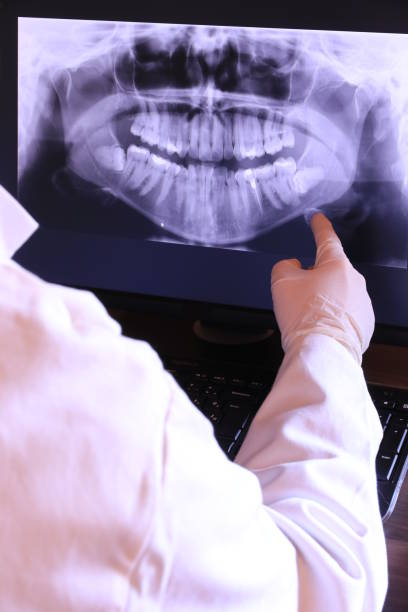Best Emergency Tooth Extraction in West Lafayette, IN